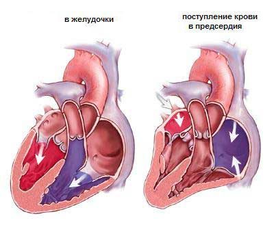 Диагностические мероприятия при хронической сердечной недостаточности